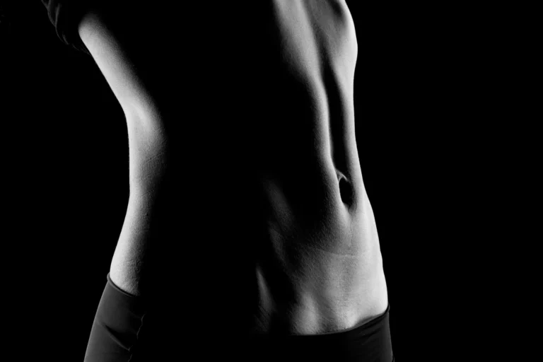 Abdominoplastia + Lipoescultura HD – Dr. Federico Ballario